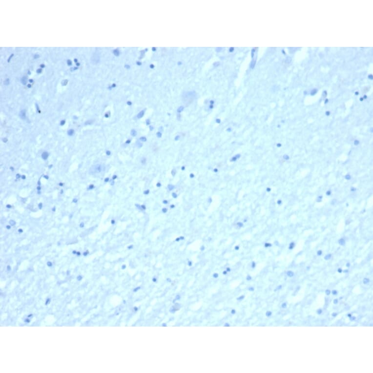 Immunohistochemistry - Anti-Inhibin alpha Antibody [INHA/6598R] - BSA and Azide free (A278598) - Antibodies.com