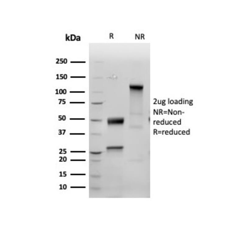 SDS-PAGE - Anti-Inhibin alpha Antibody [INHA/6598R] - BSA and Azide free (A278598) - Antibodies.com