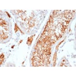 Immunohistochemistry - Anti-Inhibin alpha Antibody [INHA/6598R] - BSA and Azide free (A278598) - Antibodies.com