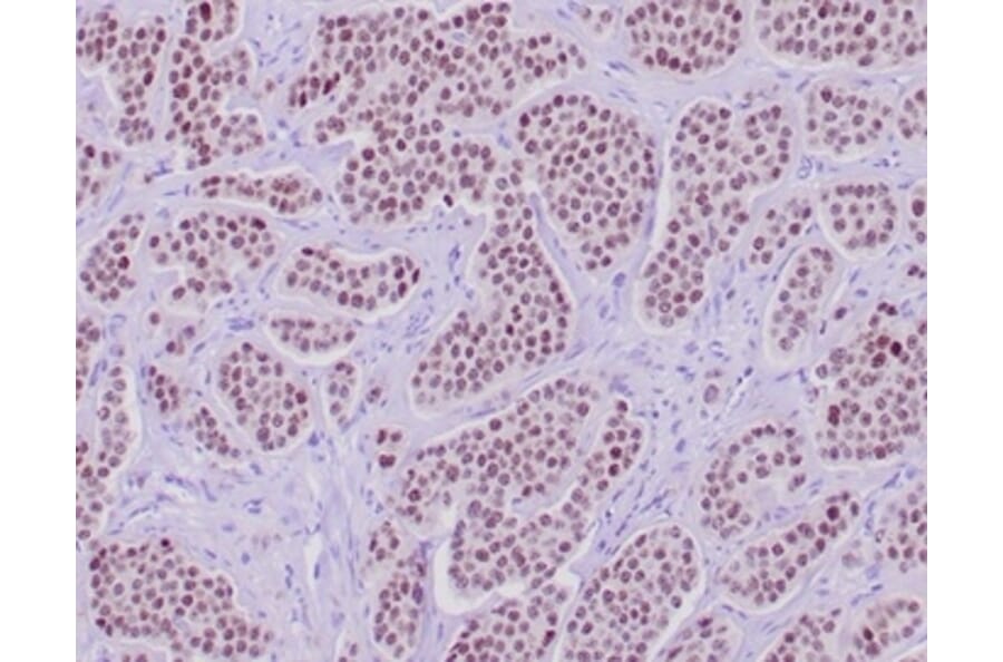 Immunohistochemistry - Anti-INSM1 Antibody [INSM1/6286R] - BSA and Azide free (A278599) - Antibodies.com