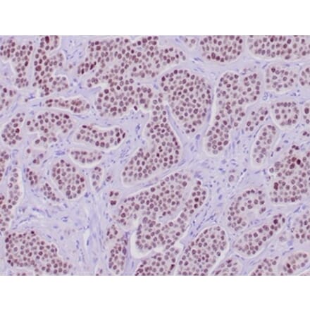 Immunohistochemistry - Anti-INSM1 Antibody [INSM1/6286R] - BSA and Azide free (A278599) - Antibodies.com