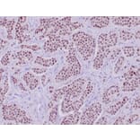 Immunohistochemistry - Anti-INSM1 Antibody [INSM1/6286R] - BSA and Azide free (A278599) - Antibodies.com