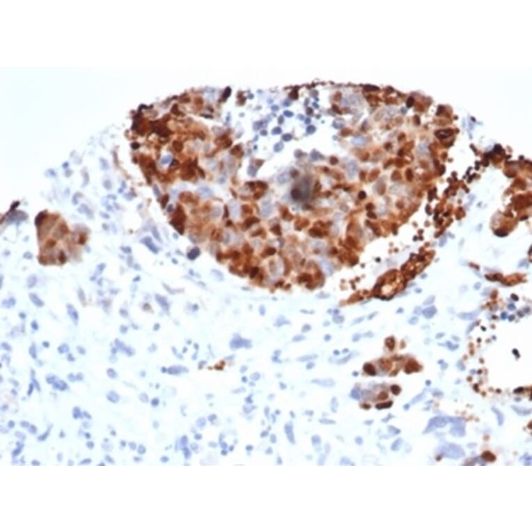 Immunohistochemistry - Anti-INSM1 Antibody [INSM1/6286R] - BSA and Azide free (A278599) - Antibodies.com