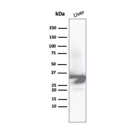 Western Blot - Anti-Arginase 1 Antibody [ARG1/6790R] - BSA and Azide free (A278600) - Antibodies.com