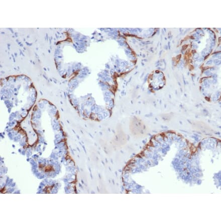 Immunohistochemistry - Anti-Cytokeratin 5 Antibody [KRT5/6399R] - BSA and Azide free (A278601) - Antibodies.com