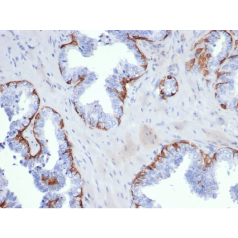 Immunohistochemistry - Anti-Cytokeratin 5 Antibody [KRT5/6399R] - BSA and Azide free (A278601) - Antibodies.com