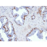 Immunohistochemistry - Anti-Cytokeratin 5 Antibody [KRT5/6399R] - BSA and Azide free (A278601) - Antibodies.com