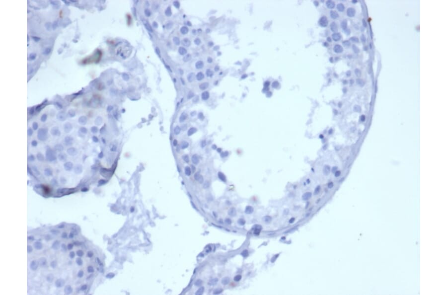 Immunohistochemistry - Anti-Cytokeratin 5 Antibody [KRT5/6399R] - BSA and Azide free (A278601) - Antibodies.com