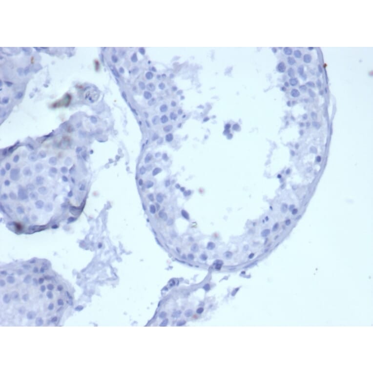 Immunohistochemistry - Anti-Cytokeratin 5 Antibody [KRT5/6399R] - BSA and Azide free (A278601) - Antibodies.com