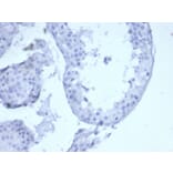 Immunohistochemistry - Anti-Cytokeratin 5 Antibody [KRT5/6399R] - BSA and Azide free (A278601) - Antibodies.com