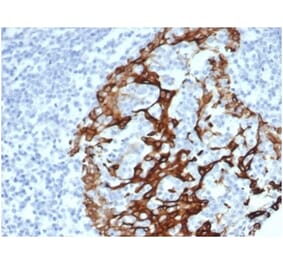 Immunohistochemistry - Anti-Cytokeratin 6A Antibody [KRT6/3997R] - BSA and Azide free (A278602) - Antibodies.com