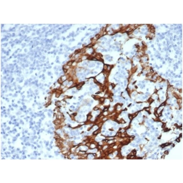 Immunohistochemistry - Anti-Cytokeratin 6A Antibody [KRT6/3997R] - BSA and Azide free (A278602) - Antibodies.com