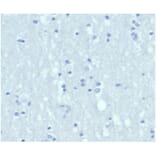 Immunohistochemistry - Anti-Cytokeratin 6A Antibody [KRT6/3997R] - BSA and Azide free (A278602) - Antibodies.com