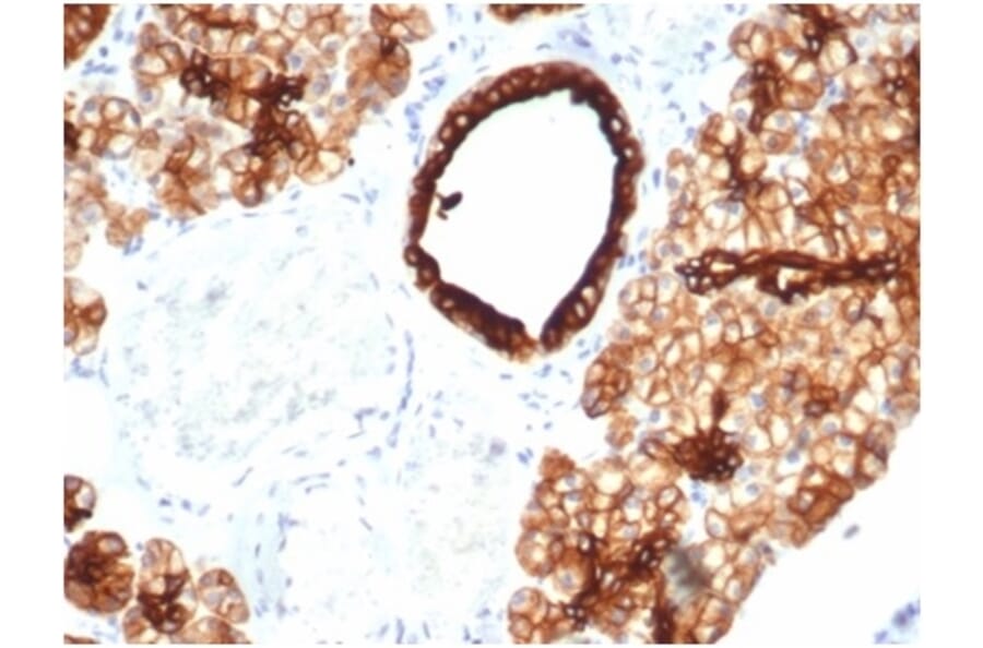Immunohistochemistry - Anti-Cytokeratin 7 Antibody [KRT7/4387R] - BSA and Azide free (A278603) - Antibodies.com