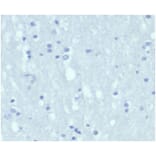 Immunohistochemistry - Anti-Cytokeratin 7 Antibody [KRT7/4387R] - BSA and Azide free (A278603) - Antibodies.com