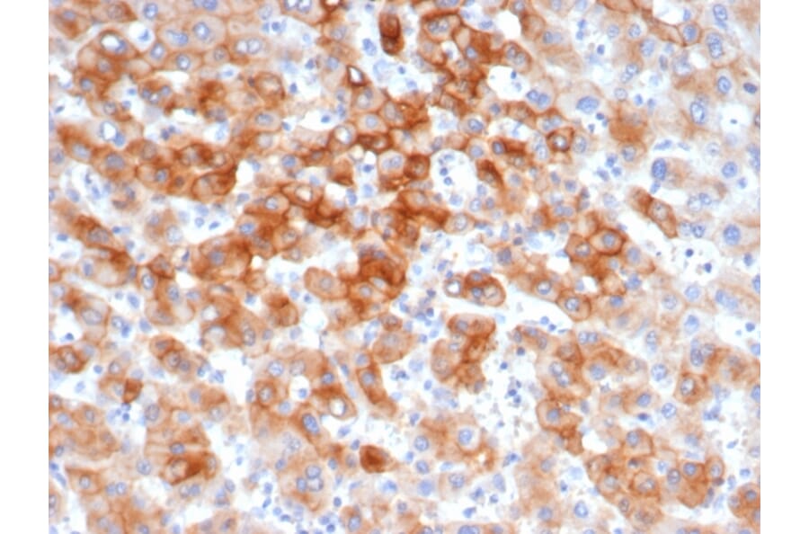 Immunohistochemistry - Anti-Cytokeratin 8 Antibody [KRT8/6472R] - BSA and Azide free (A278605) - Antibodies.com