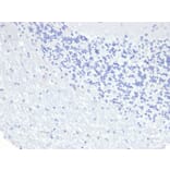 Immunohistochemistry - Anti-Cytokeratin 8 Antibody [KRT8/6472R] - BSA and Azide free (A278605) - Antibodies.com