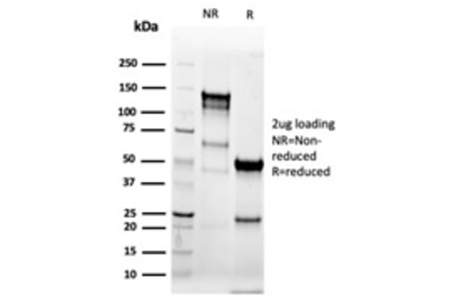 SDS-PAGE - Anti-Cytokeratin 8 Antibody [KRT8/6472R] - BSA and Azide free (A278605) - Antibodies.com
