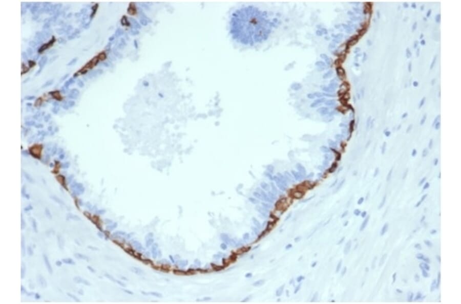 Immunohistochemistry - Anti-Cytokeratin 14 Antibody [KRT14/4584R] - BSA and Azide free (A278606) - Antibodies.com