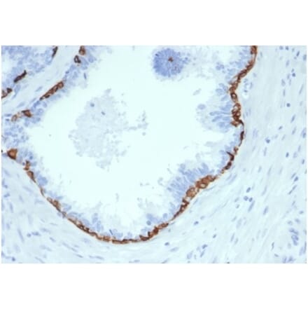Immunohistochemistry - Anti-Cytokeratin 14 Antibody [KRT14/4584R] - BSA and Azide free (A278606) - Antibodies.com