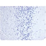 Immunohistochemistry - Anti-Cytokeratin 14 Antibody [KRT14/4584R] - BSA and Azide free (A278606) - Antibodies.com