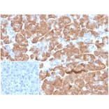 Immunohistochemistry - Anti-67kDa Laminin Receptor Antibody [RPSA/6332R] - BSA and Azide free (A278608) - Antibodies.com