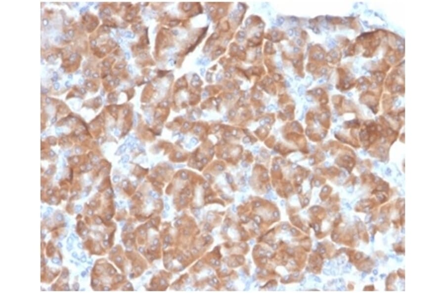Immunohistochemistry - Anti-67kDa Laminin Receptor Antibody [RPSA/6332R] - BSA and Azide free (A278608) - Antibodies.com