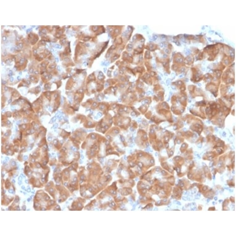 Immunohistochemistry - Anti-67kDa Laminin Receptor Antibody [RPSA/6332R] - BSA and Azide free (A278608) - Antibodies.com