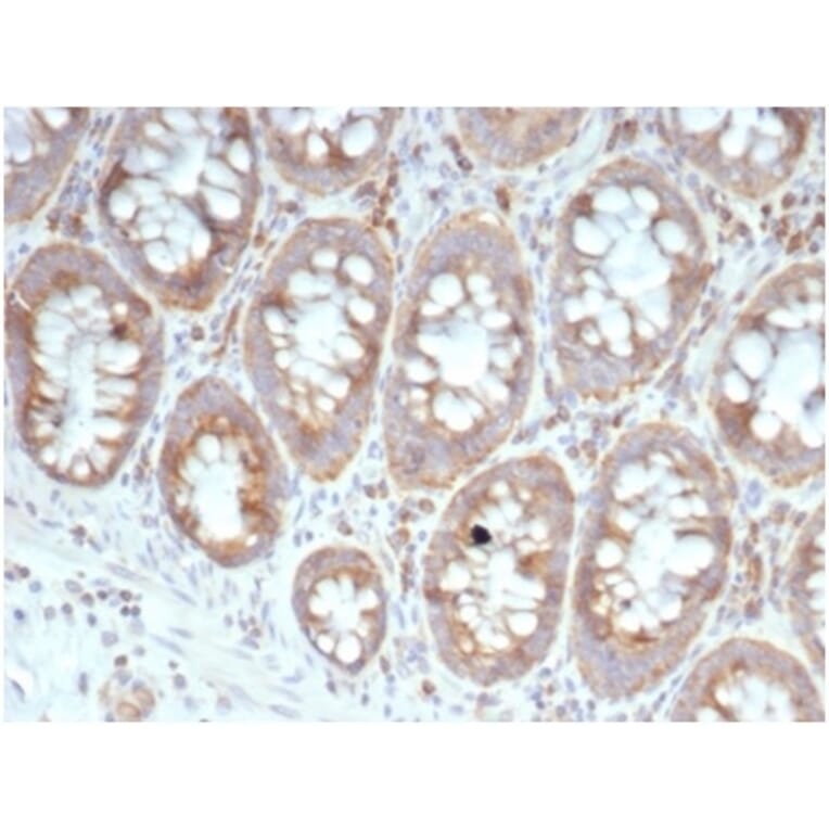 Immunohistochemistry - Anti-67kDa Laminin Receptor Antibody [RPSA/6332R] - BSA and Azide free (A278608) - Antibodies.com