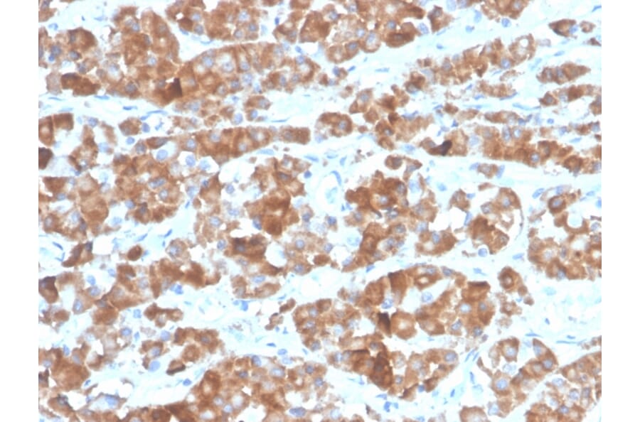 Immunohistochemistry - Anti-Luteinizing Hormone beta Antibody [LHb/1612R] - BSA and Azide free (A278610) - Antibodies.com
