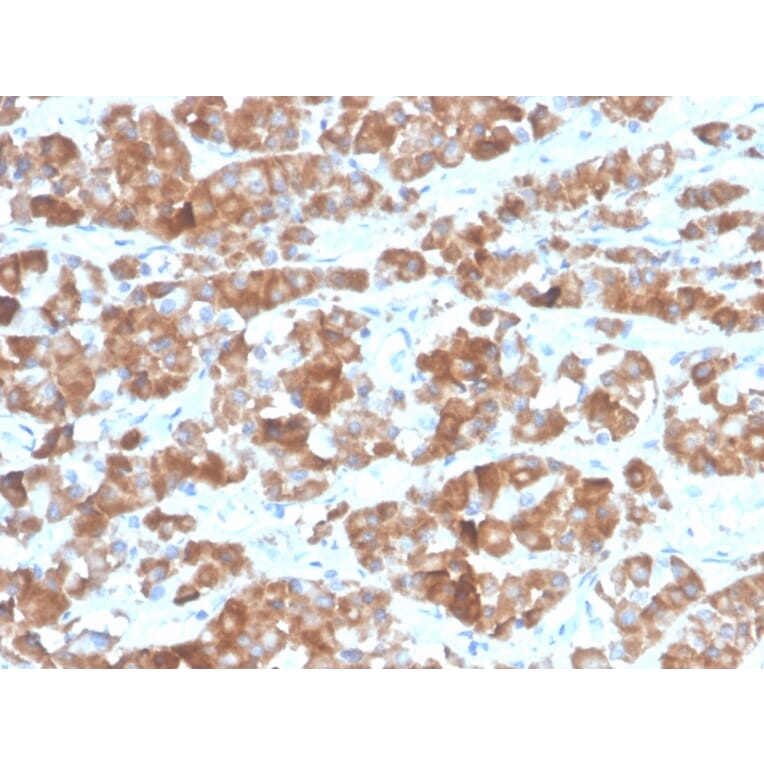 Immunohistochemistry - Anti-Luteinizing Hormone beta Antibody [LHb/1612R] - BSA and Azide free (A278610) - Antibodies.com