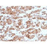 Immunohistochemistry - Anti-Luteinizing Hormone beta Antibody [LHb/1612R] - BSA and Azide free (A278610) - Antibodies.com