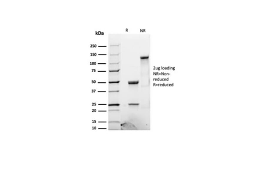 SDS-PAGE - Anti-Luteinizing Hormone beta Antibody [LHb/1612R] - BSA and Azide free (A278610) - Antibodies.com