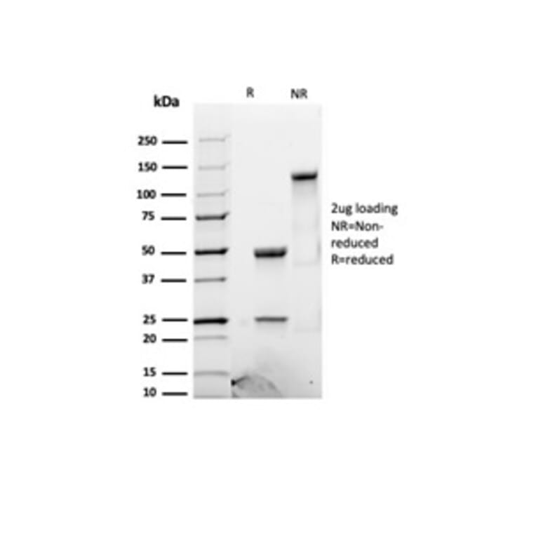 SDS-PAGE - Anti-Luteinizing Hormone beta Antibody [LHb/1612R] - BSA and Azide free (A278610) - Antibodies.com