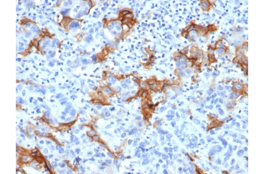Immunohistochemistry - Anti-TROP2 Antibody [TACSTD2/6394R] - BSA and Azide free (A278611) - Antibodies.com