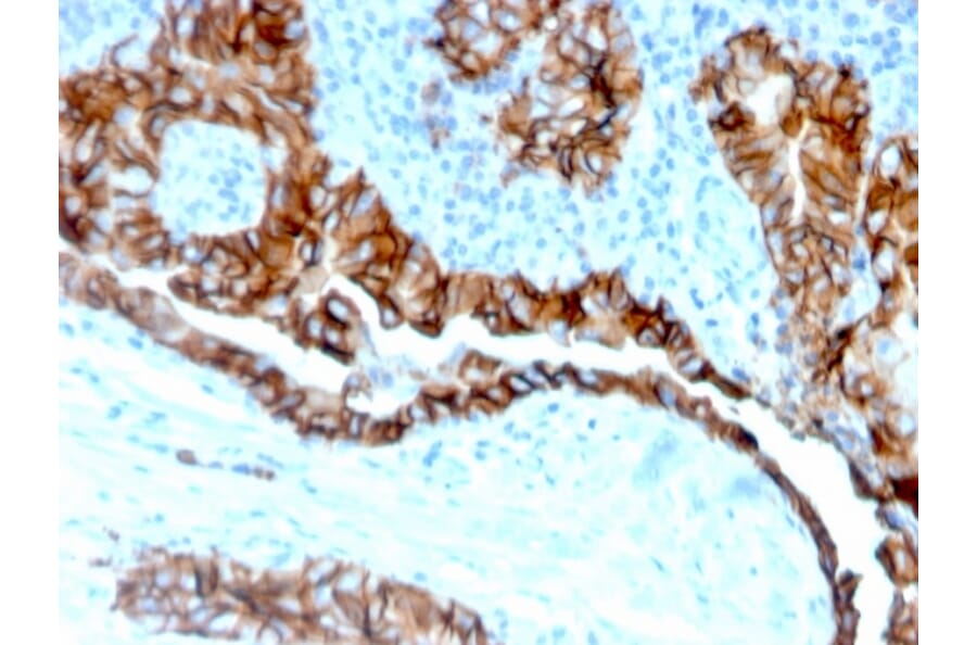 Immunohistochemistry - Anti-TROP2 Antibody [TACSTD2/6394R] - BSA and Azide free (A278611) - Antibodies.com