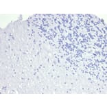 Immunohistochemistry - Anti-TROP2 Antibody [TACSTD2/6394R] - BSA and Azide free (A278611) - Antibodies.com