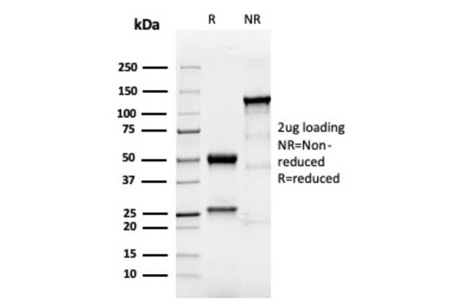 SDS-PAGE - Anti-TROP2 Antibody [TACSTD2/6394R] - BSA and Azide free (A278611) - Antibodies.com