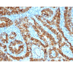 Immunohistochemistry - Anti-TROP2 Antibody [TACSTD2/6396R] - BSA and Azide free (A278612) - Antibodies.com