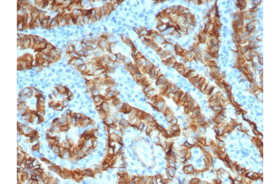 Immunohistochemistry - Anti-TROP2 Antibody [TACSTD2/6396R] - BSA and Azide free (A278612) - Antibodies.com