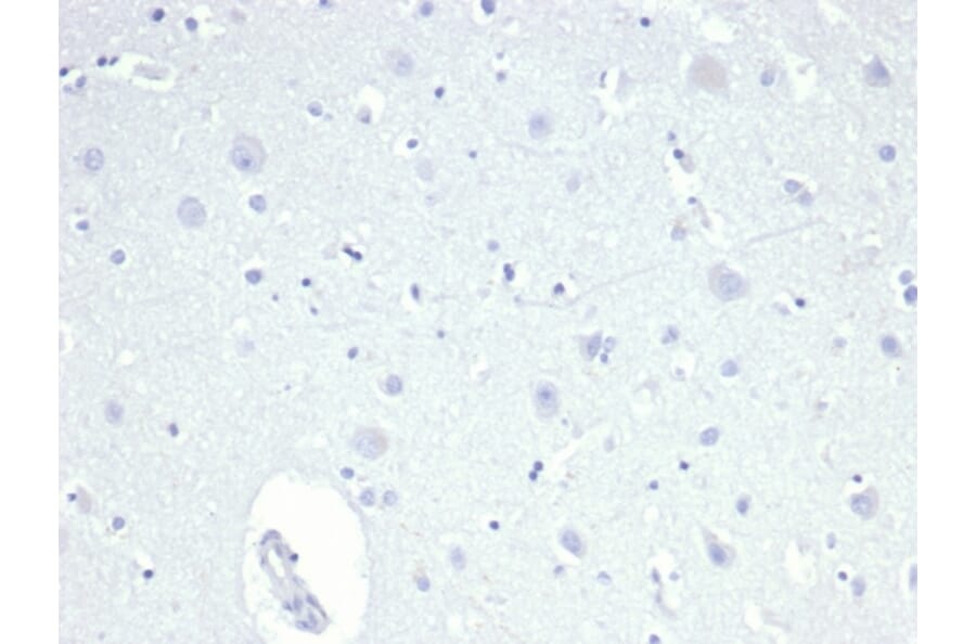 Immunohistochemistry - Anti-TROP2 Antibody [TACSTD2/6396R] - BSA and Azide free (A278612) - Antibodies.com