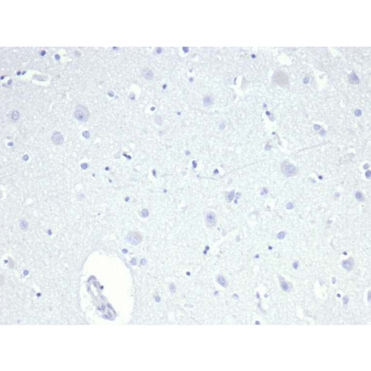 Immunohistochemistry - Anti-TROP2 Antibody [TACSTD2/6396R] - BSA and Azide free (A278612) - Antibodies.com