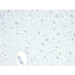 Immunohistochemistry - Anti-TROP2 Antibody [TACSTD2/6396R] - BSA and Azide free (A278612) - Antibodies.com