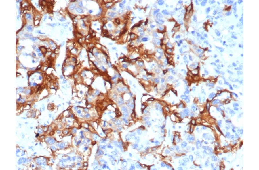 Immunohistochemistry - Anti-TROP2 Antibody [TACSTD2/6396R] - BSA and Azide free (A278612) - Antibodies.com
