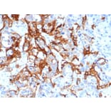 Immunohistochemistry - Anti-TROP2 Antibody [TACSTD2/6396R] - BSA and Azide free (A278612) - Antibodies.com