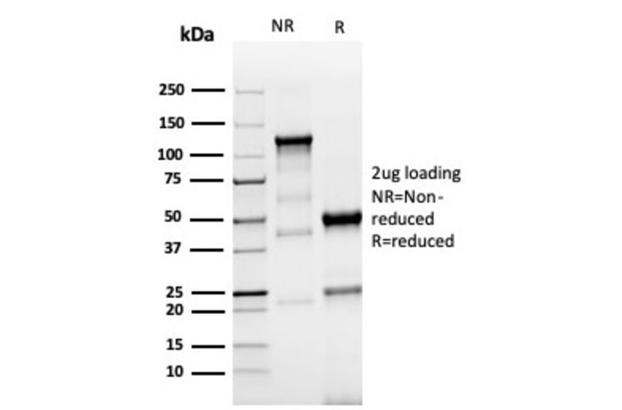 SDS-PAGE - Anti-TROP2 Antibody [TACSTD2/6396R] - BSA and Azide free (A278612) - Antibodies.com
