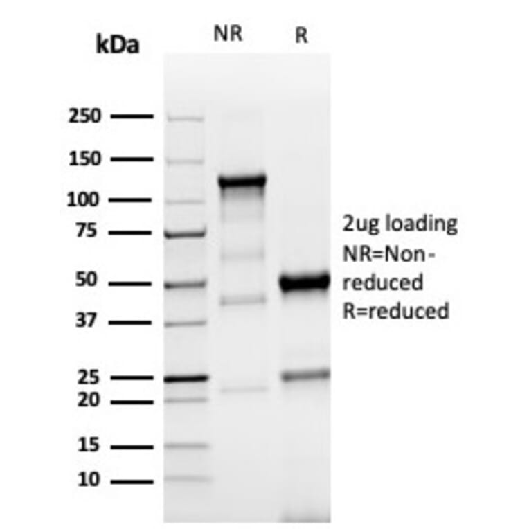 SDS-PAGE - Anti-TROP2 Antibody [TACSTD2/6396R] - BSA and Azide free (A278612) - Antibodies.com