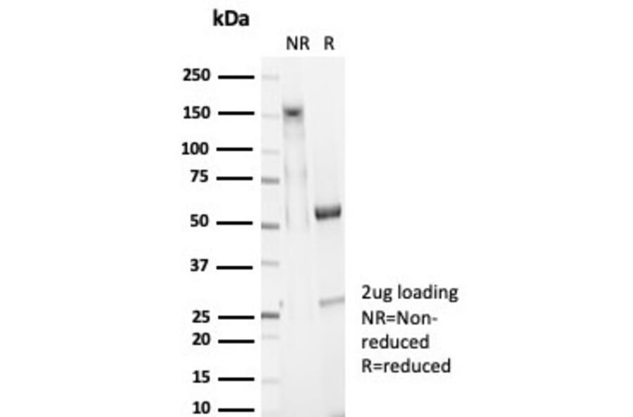 SDS-PAGE - Anti-EpCAM Antibody [EGP40/7025R] - BSA and Azide free (A278613) - Antibodies.com