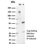 SDS-PAGE - Anti-EpCAM Antibody [EGP40/7025R] - BSA and Azide free (A278613) - Antibodies.com