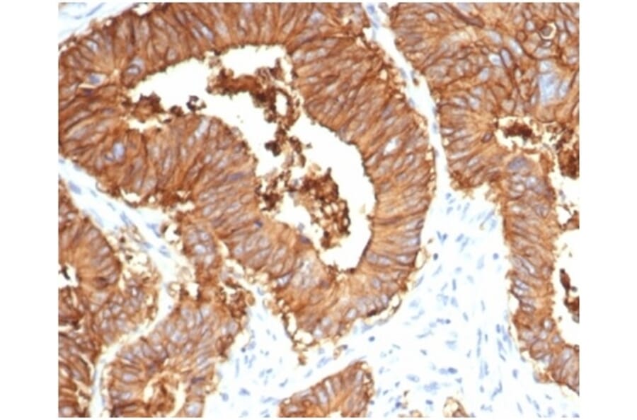 Immunohistochemistry - Anti-EpCAM Antibody [EGP40/7035R] - BSA and Azide free (A278614) - Antibodies.com